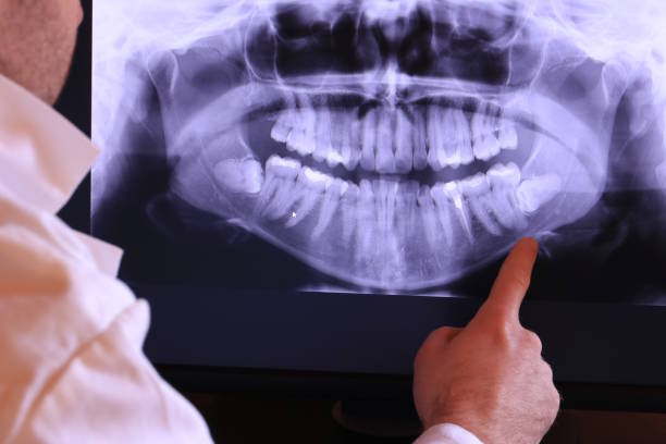 Best Emergency Gum Treatment in Rayne, LA